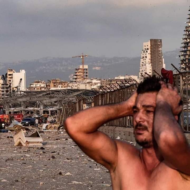 إصابة زوجة فنان لبناني خلال انفجار بيروت (صور)