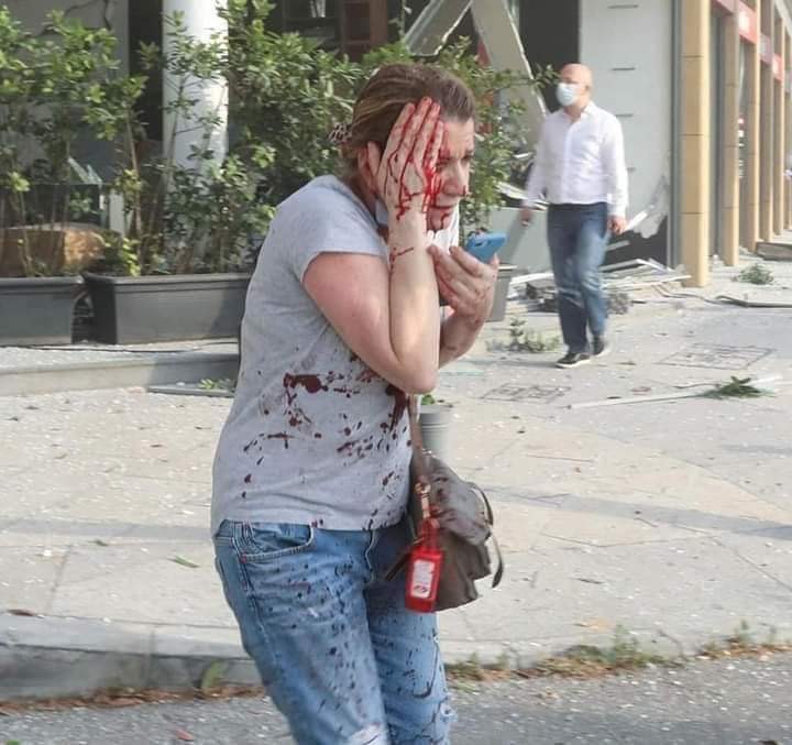 أندية كرة القدم تتضامن مع ضحايا انفجار لبنان